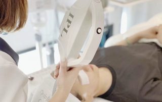 huafeimedical IPL treatment..jpg.