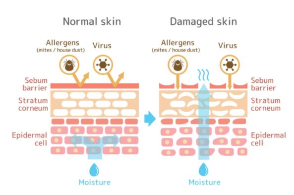 skin barrier