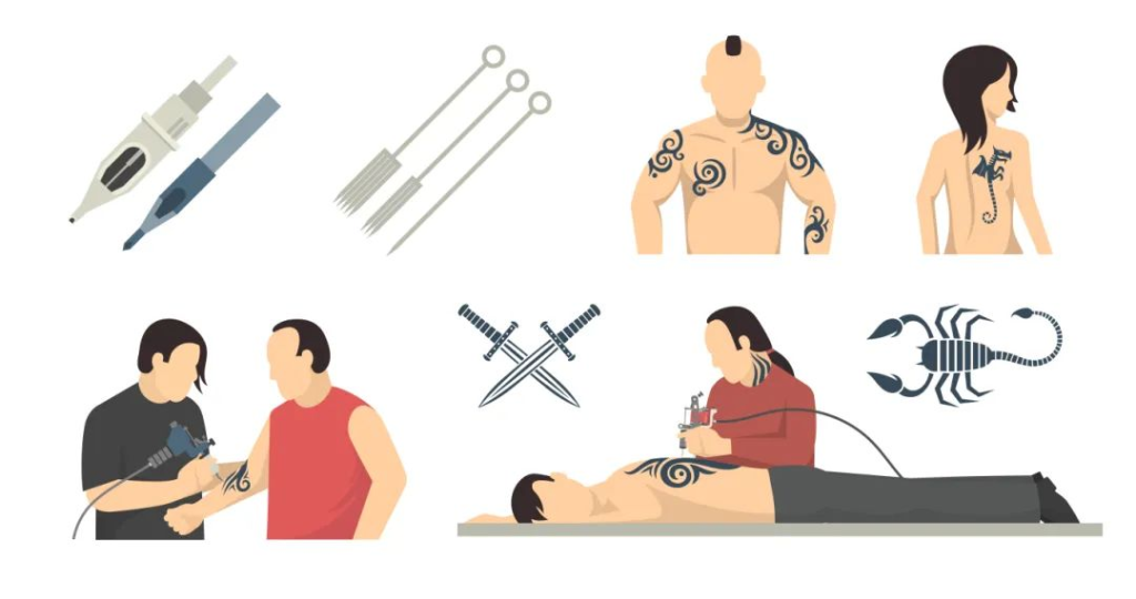 Laser tattoo removal