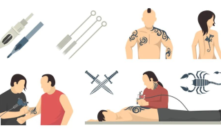Laser tattoo removal
