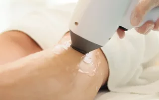 Best Hair Removal Methods for Smooth Skin in 2025