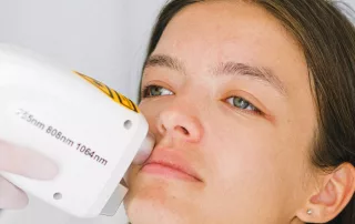 How to Select the Perfect Diode Laser Hair Removal Device for Your Needs
